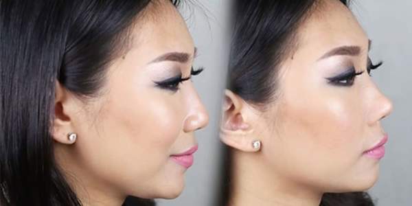 High Stealth Nose Lifter