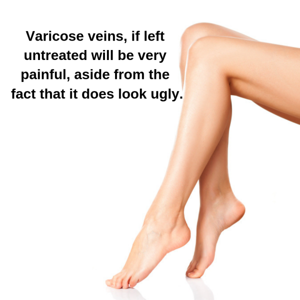 Organic Varicose Vein Healing Cream by Soo Yun™