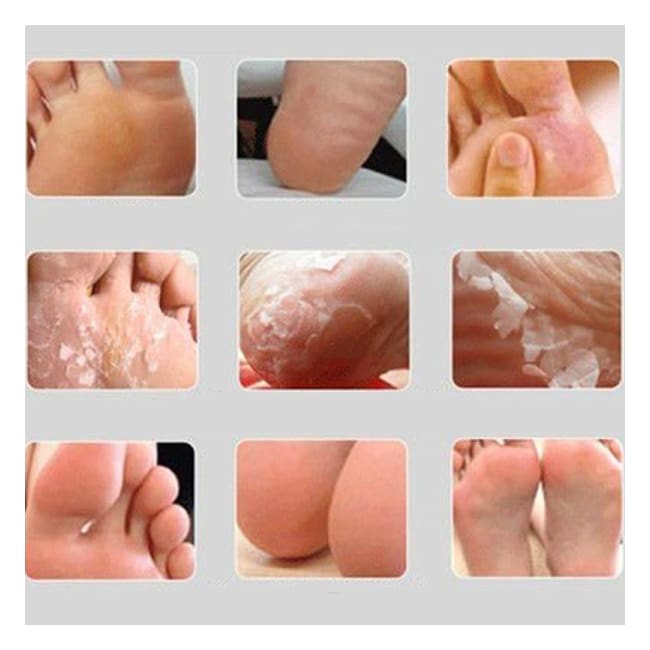 Perfect Silver Exfoliating Foot Peeling Mask peel Exfoliation exfoliates